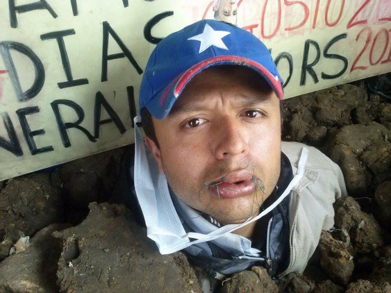 Support the injured Colombian GM workers with a phone call!