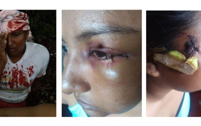Violentas agresiones por parte de la fuerza pública dejan dos personas gravemente heridas en los municipios de Cartagena del Chairá y San José de Fragua.